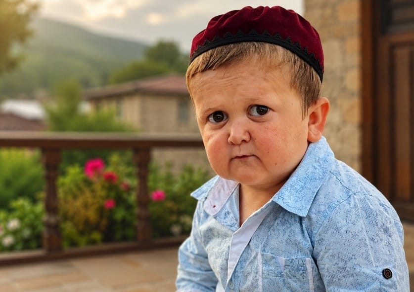Hasbulla Magomedov Disease