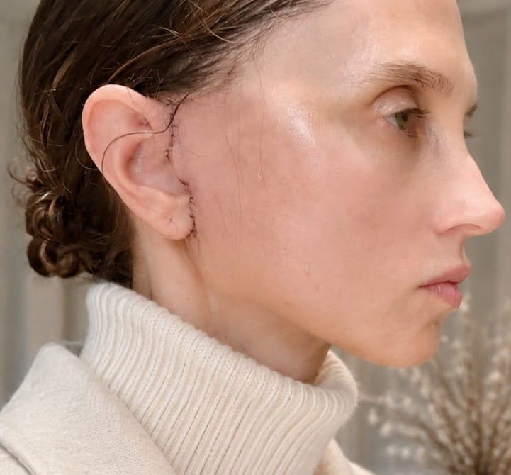 Stacey Bendet No-Makeup Look